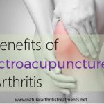 6 Surprising Benefits of Electroacupuncture in Arthritis